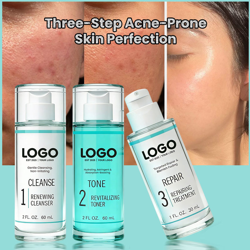 GUOCUI BIO TECH Glycolic Acid Acne-Fighting Oil Control Facial Cleanser Hydration Fades Post-Acne Marks Toner Repair Skin Lotion