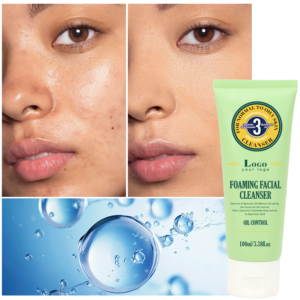 GUOCUI BIO TECH Pore Refining Gentle Facial Wash Oil Control Acne Repair Hyaluronic Acid Foam Face Cleanser for Oily Skin