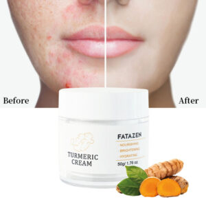 Wholesale Skin Care Products Anti Aging Moisturizer Face Whitening Cream OEM Anti Wrinkle Acne Vitamin C Turmeric Facial Cream