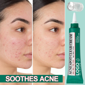 FATAZEN Soothes Breakouts Deeply Moisturizes Fades Dark Spots Balances Skin Oil Water Gentle Formula Acne Spot Clearing Cream