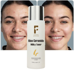 FATAZEN High Quality Private Label Hydrating Moisturizing Ance Treatment Natural Rice Ceramide Face Toner OEM Facial Toner