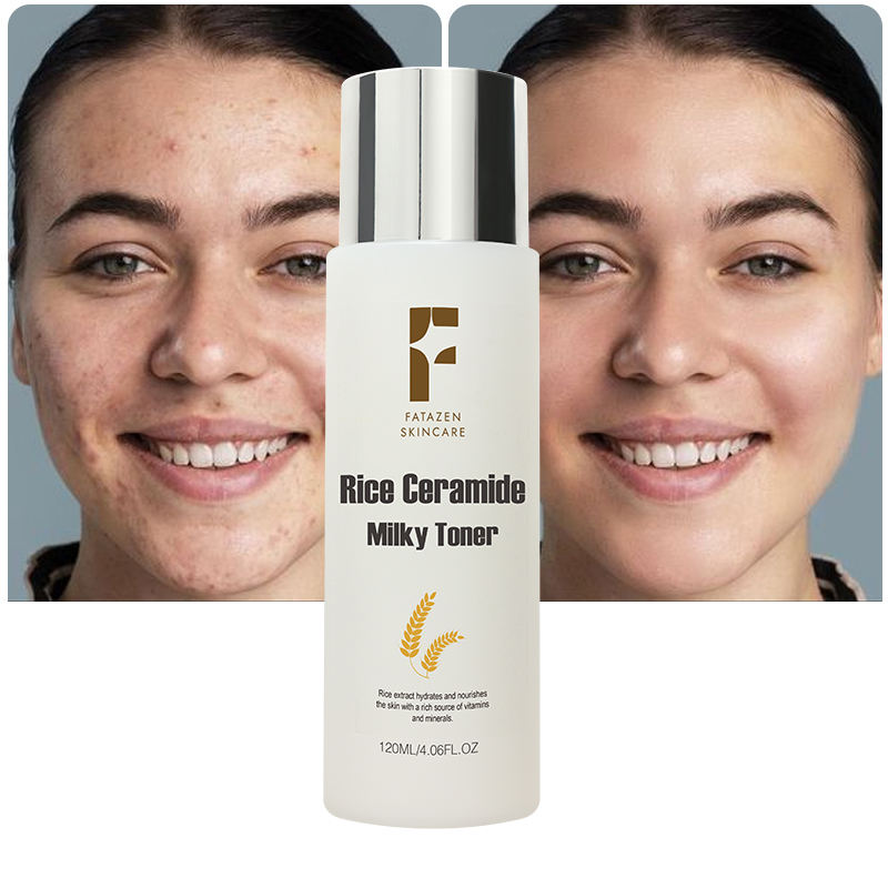 FATAZEN High Quality Private Label Hydrating Moisturizing Ance Treatment Natural Rice Ceramide Face Toner OEM Facial Toner