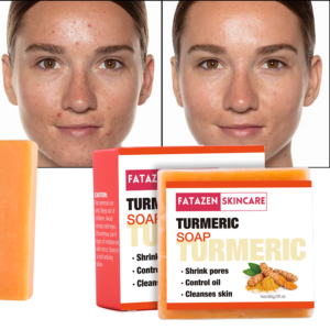 White Skin Care Products Whitening Turmeric Soap Bar OEM ODM Face Soap Natural Plant Anti Acne Handmade Bath Soap