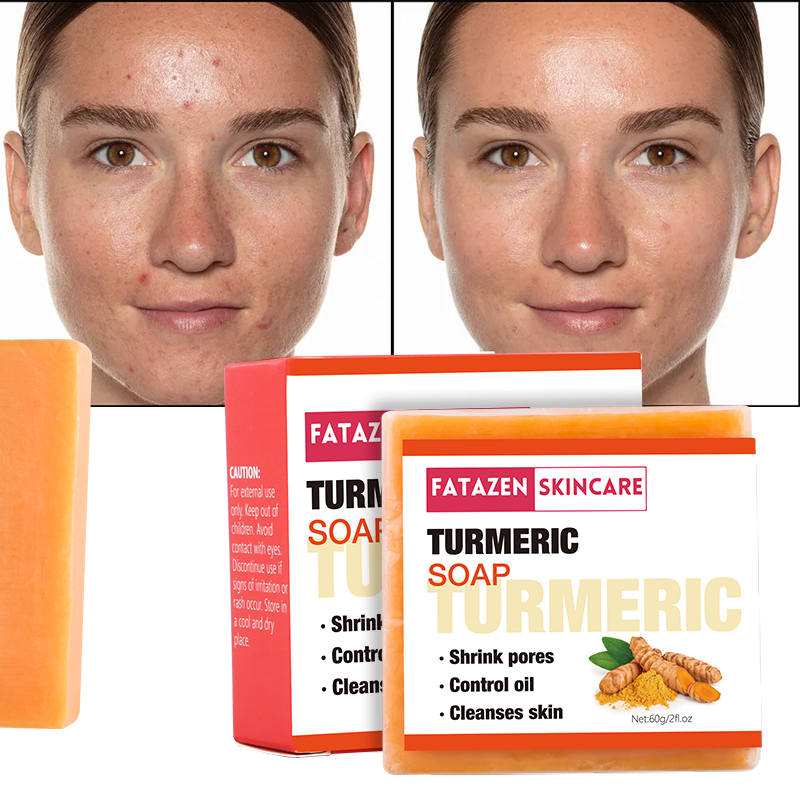 White Skin Care Products Whitening Turmeric Soap Bar OEM ODM Face Soap Natural Plant Anti Acne Handmade Bath Soap