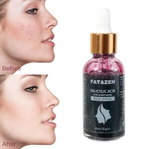Private Label Skincare BHA2% Multivitamins Moisturizing Face Essence Brightening Non-sticky Texture Salicylic Acid Facial Serum