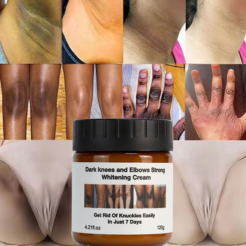 Private Label Extreme Anti Dark Spot Wrinkle Knees Elbows Vitamin Body Care White Lotion Moisturizer Face Body Whitening Cream