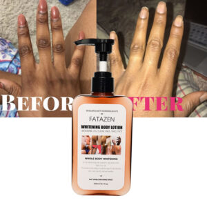 Hot Selling Skin Care Organic Arbutin Skin Moisturizer Exfoliating Cream Anti Dark Spot Moisturizing Whitening Body Lotion