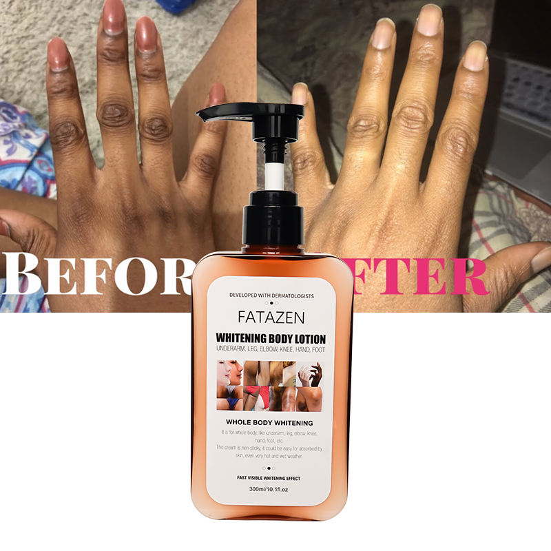 Hot Selling Skin Care Organic Arbutin Skin Moisturizer Exfoliating Cream Anti Dark Spot Moisturizing Whitening Body Lotion