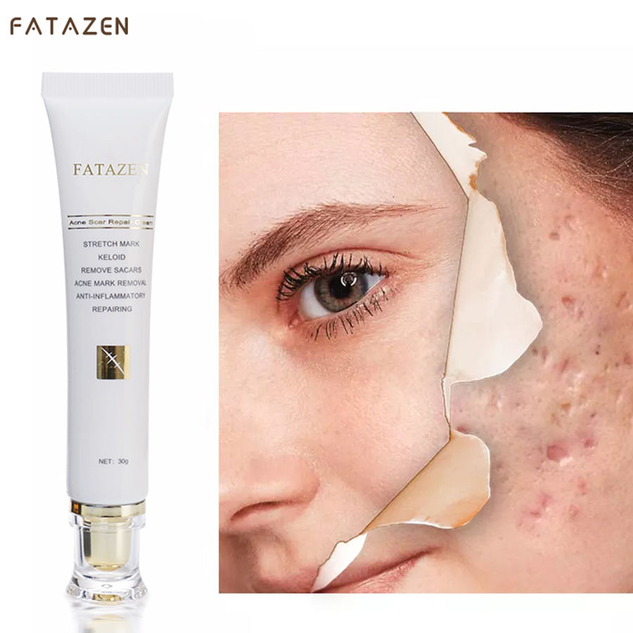 FATAZEN High Quality Organic Natural Herbal Skin Repairing Cream Pregnancy Stretch Mark Pimple Anti Acne Scar Repair Cream