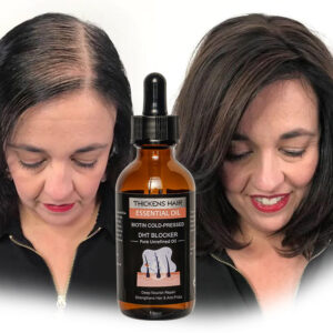 Private Label Hair Growth Serum Oil Biotin Regrowth Treatment for Scalp Hair Loss Thinning Hair Growth Serum for Men Women