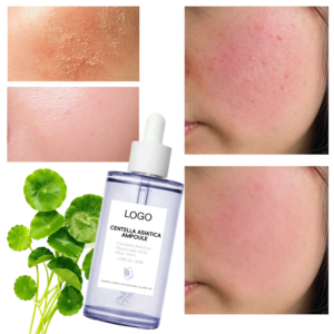 GUOCUI BIO TECH Natural Pore Refining Anti-aging Anti-wrinkle Ance Treatment Moisturizing Pure Centella Asiatica Ampoule Serum