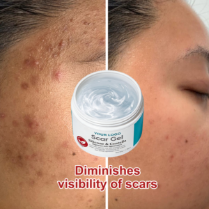 Private Label Fast Repairing Fading Softening Smoothing Invisible Natural Healthy Clear Smooth Medical Grade Silicone Scar Gel