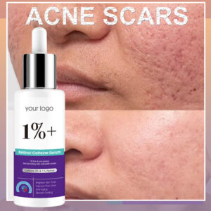 GUOCUI BIO TECH High Quality Reduce Fine Lines Wrinkle Intense Acne Repair Series Products 1% Retinol & 3% Caffeine Serum
