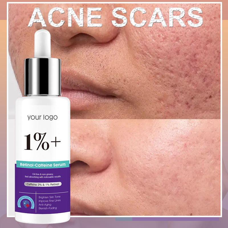 GUOCUI BIO TECH High Quality Reduce Fine Lines Wrinkle Intense Acne Repair Series Products 1% Retinol & 3% Caffeine Serum